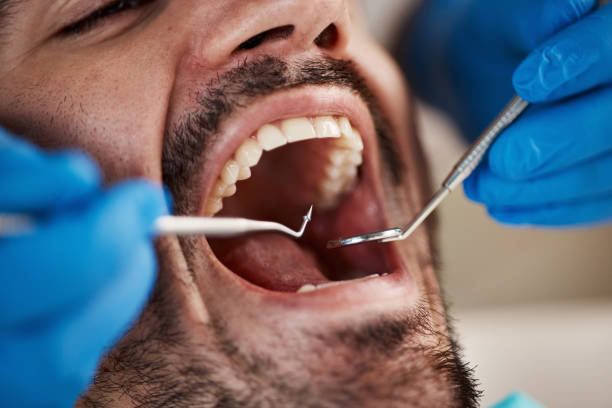 Best Emergency Dental Care for Sports Injuries in Chleston, AR